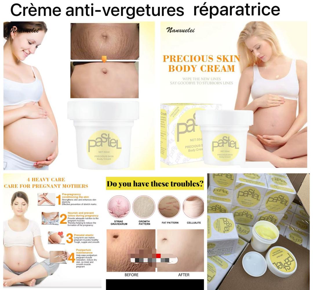 Crème anti vergetures
