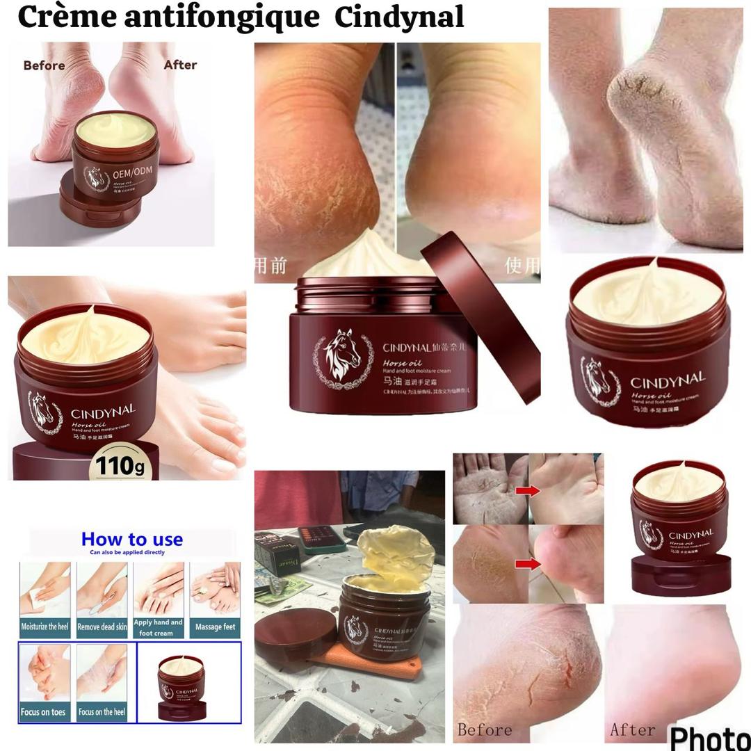 Crème antifongique cyndinal